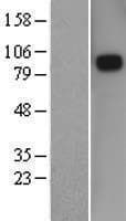 SEMA3D / Semaphorin 3D Protein (Over-Expression Lysate Myc-DDK (Flag))