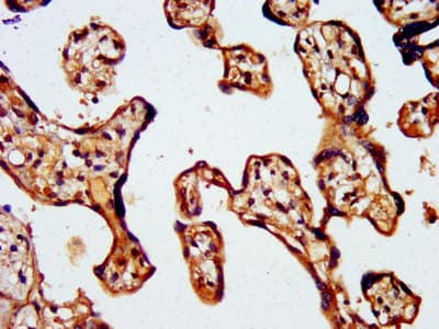 WASF2 / SCAR2 Antibody
