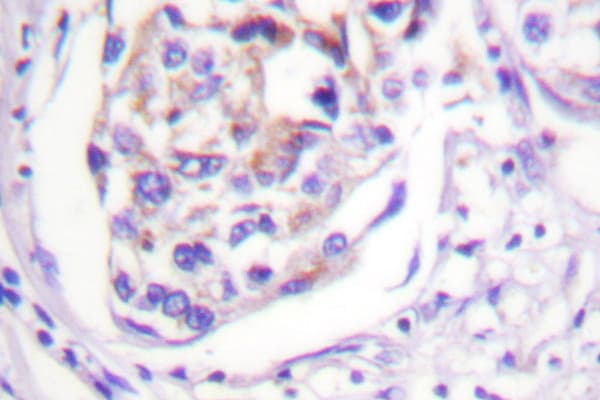 IRS1 Antibody (Val317)