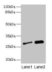 Polyclonal Rabbit anti-Human IGFBP1 Antibody (WB)
