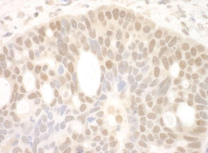 Polyclonal Rabbit anti-Human RBM17 Antibody (aa25-75, IHC)