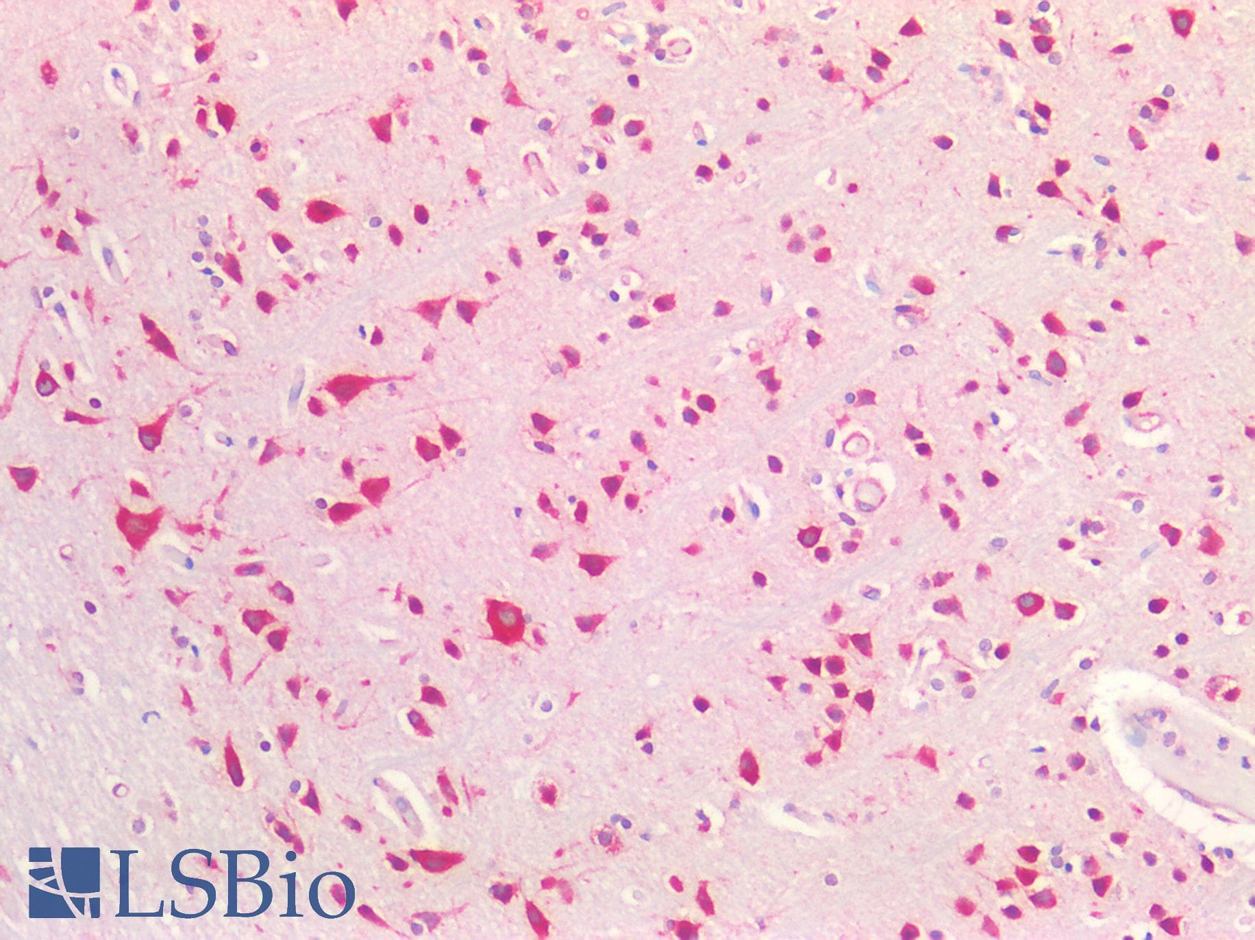 IHC-plus™ Polyclonal Rabbit anti-Human L1CAM Antibody (IHC)