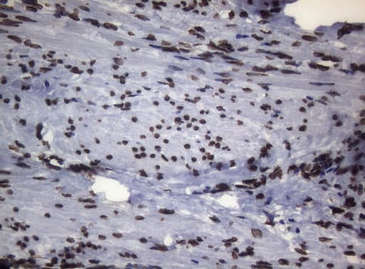 BCL6 Antibody (aa1-300, clone OTI1C3, Carrier-free)