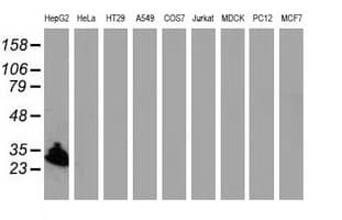 SULT1A1 / Sulfotransferase 1A1 Antibody (clone OTI6C8)