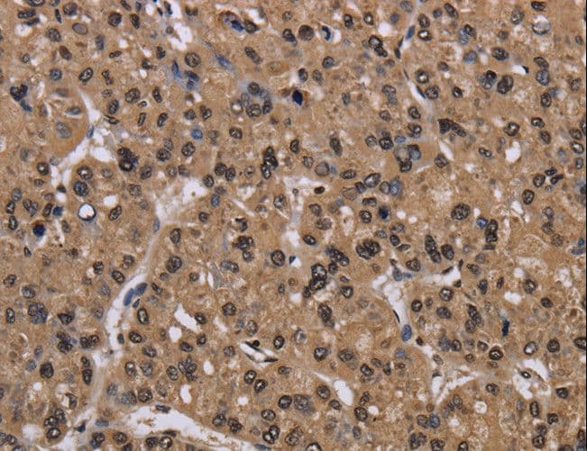 CSNK2A1 Antibody
