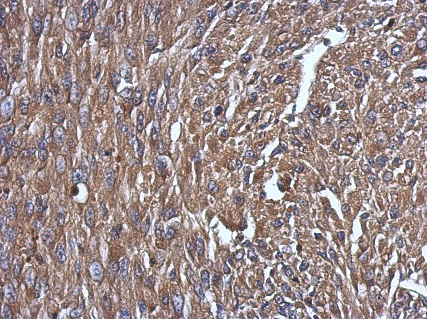 Polyclonal Rabbit anti-Human NPC2 Antibody (IHC, WB)