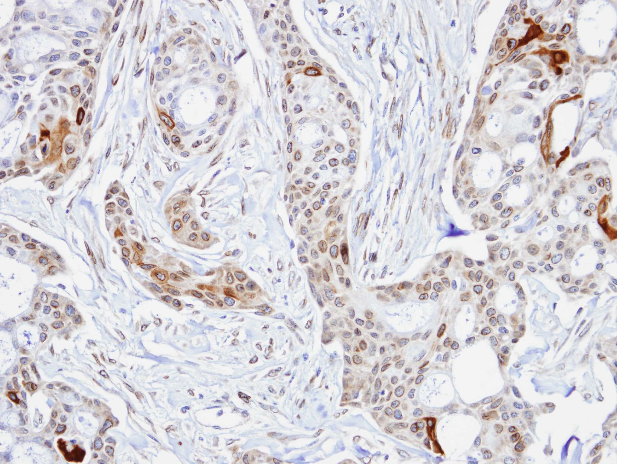 STI1 / STIP1 Antibody (aa1-300)