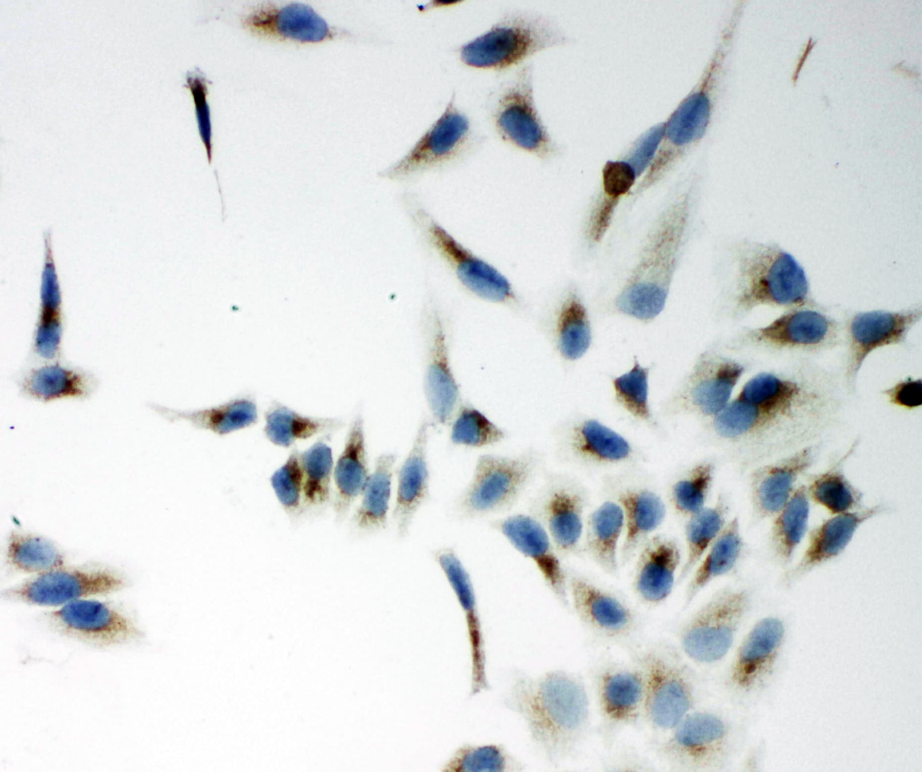 Polyclonal Rabbit anti-Human NOX5 Antibody (aa747-765, IHC, WB)