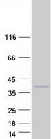 Human FAM49B / L1 Protein (Recombinant Myc-DDK (Flag))