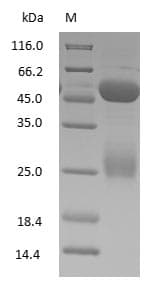 Sheep IgG Protein (Native)