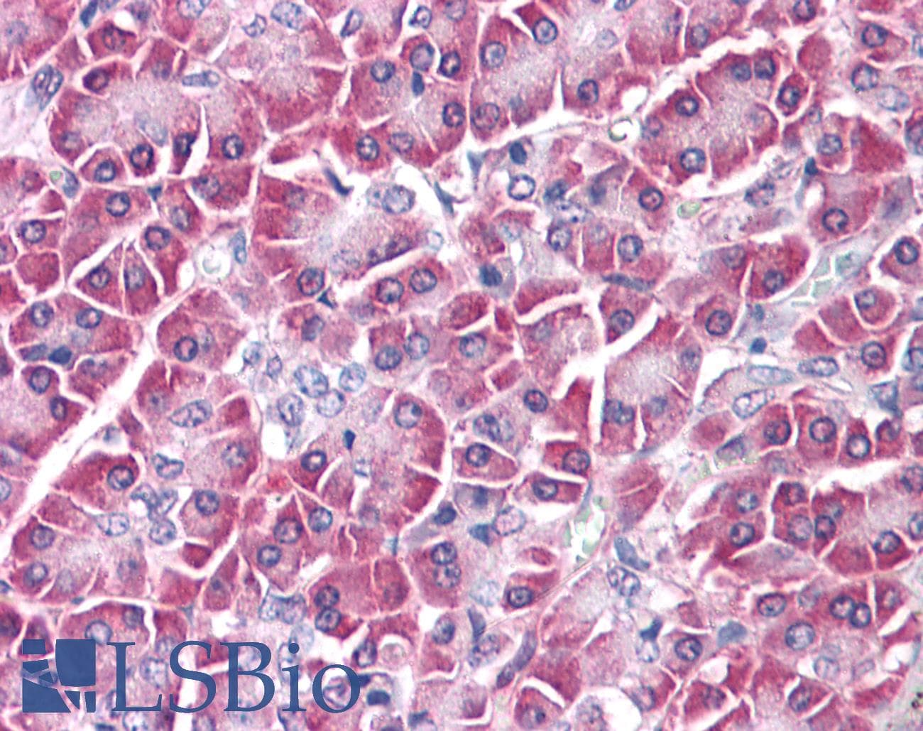 IHC-plus™ Polyclonal Rabbit anti-Human GPC4 / Glypican 4 Antibody (N-Terminus, IHC)