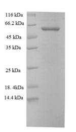 Human KRT6A / CK6A / Cytokeratin 6A Protein (Recombinant GST, N-terminus)