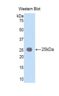 IL1RAP Antibody (aa65-249)