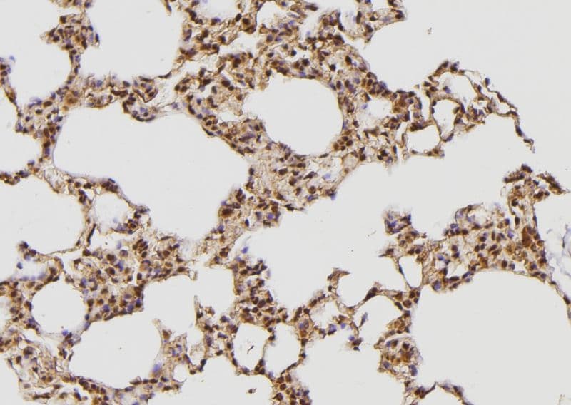 Tuberin / TSC2 Antibody