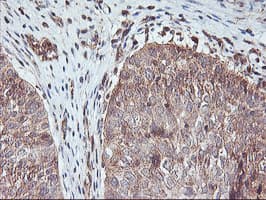 AGPAT5 Antibody (clone OTI1D4)