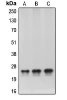 CBX5 / HP1 Alpha Antibody (Internal)