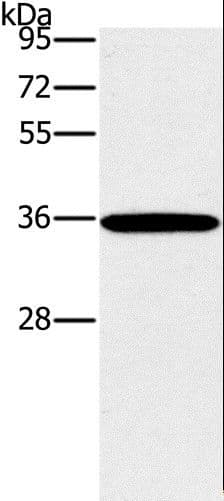 FRA-1 / FOSL1 Antibody