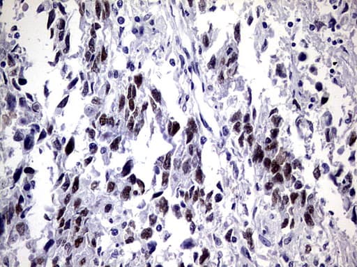 ZNF34 Antibody (aa117-405, clone OTI3G2, Carrier-free)