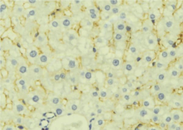 LETMD1 / HCCR1 Antibody