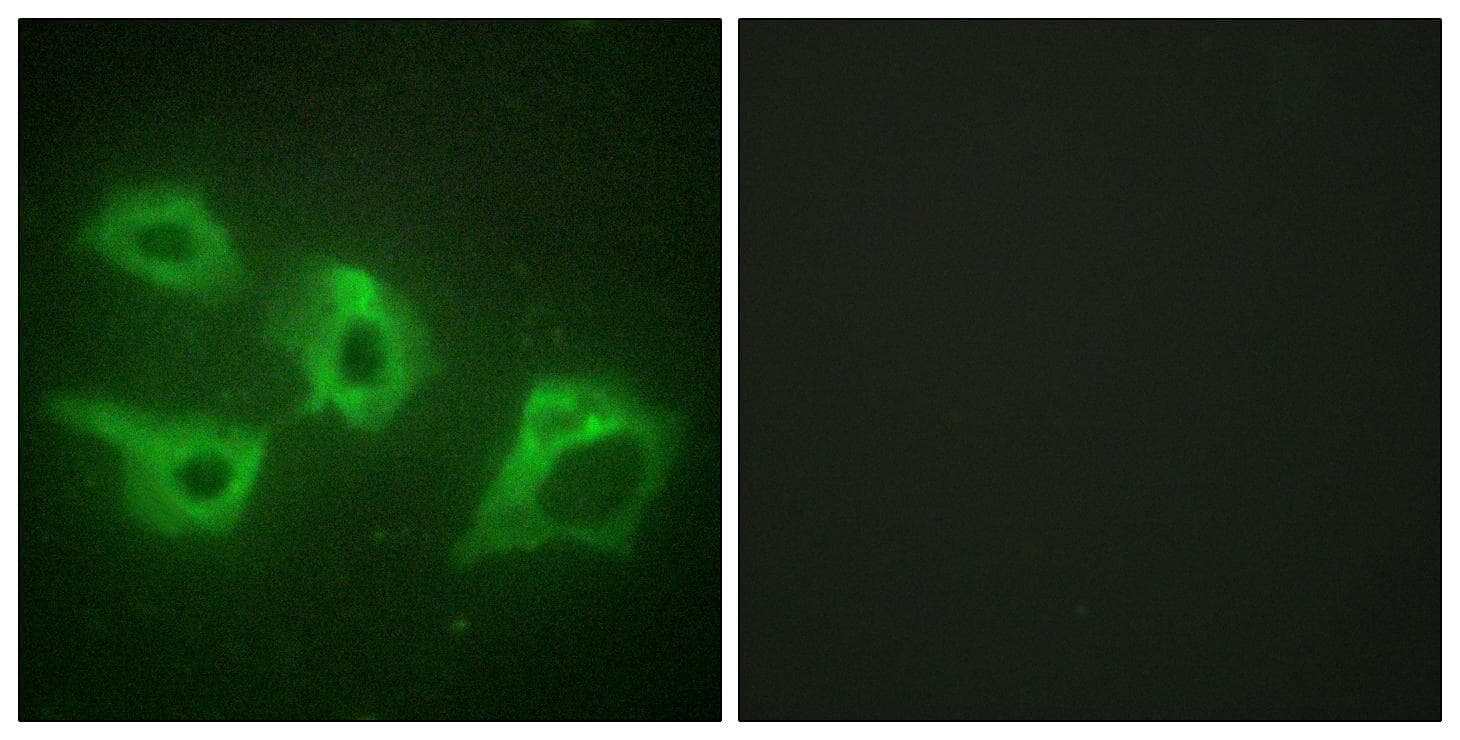 CSNK1A1 / CK1 Alpha Antibody