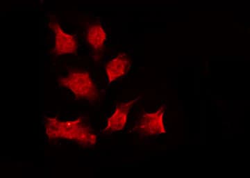 CHEK1 / CHK1 Antibody (phospho-Ser301)