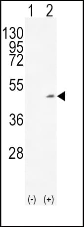 Polyclonal Rabbit anti-Human ADH1C Antibody (aa231-260, IHC, IF, WB)