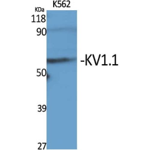 Polyclonal Rabbit anti-Human KCNA1 / Kv1.1 Antibody (230-310 aa, Internal, WB)