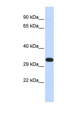 Polyclonal Rabbit anti-Human KIF25 Antibody (N-Terminus, WB)