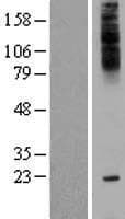 TMEM241 Protein (Over-Expression Lysate Myc-DDK (Flag))
