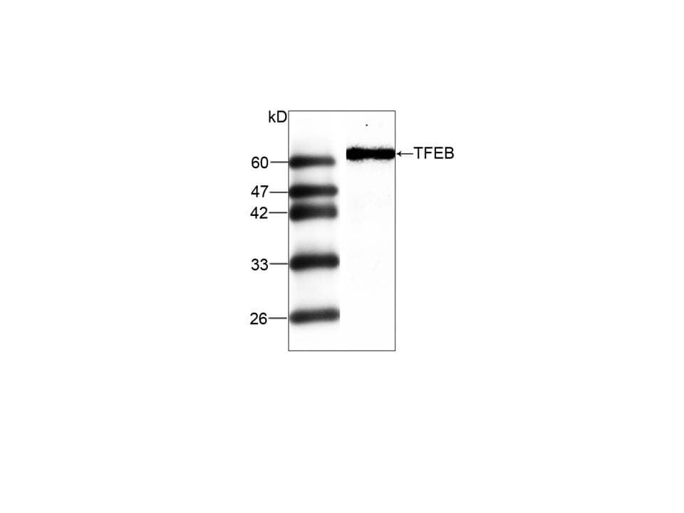 Monoclonal Mouse anti-Human TFEB Antibody (WB)