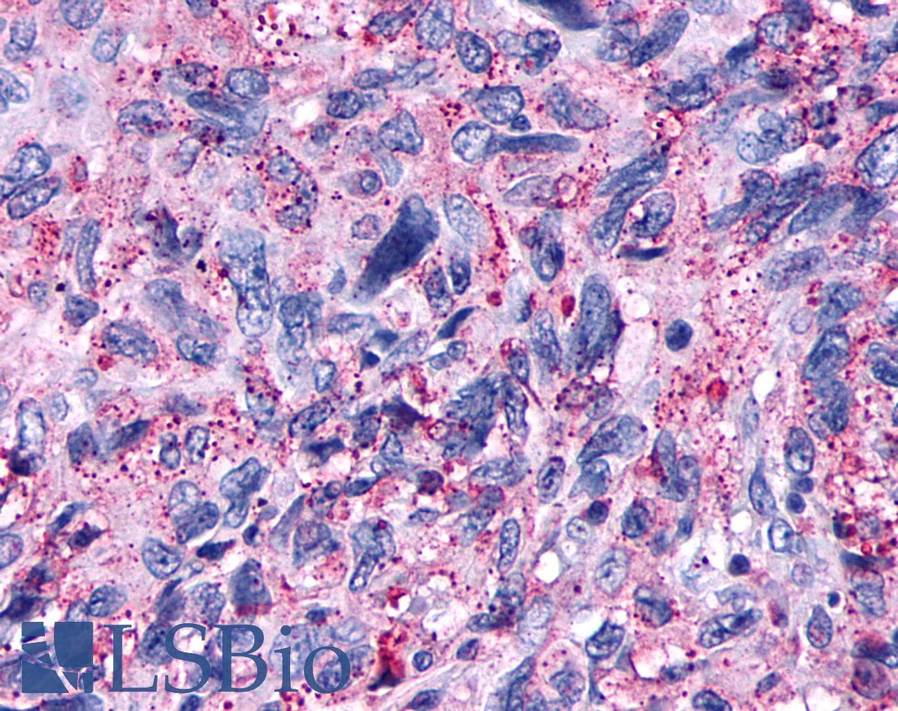 PathPlus™ Polyclonal Rabbit anti-Human OPRD1 / Delta Opioid Receptor Antibody (N-Terminus, IHC)