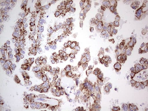LRRC6 Antibody (clone OTI2F8, Carrier-free)