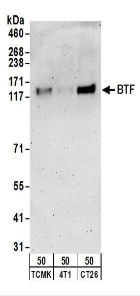 IHC-plus™ BTF / BCLAF1 Antibody (aa150-200)