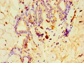 GPS1 / CSN1 Antibody (aa222-491)