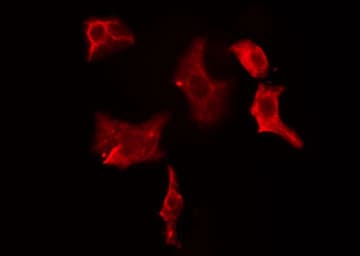 Polyclonal Rabbit anti-Human CBR / CBR1 Antibody (IHC, IF, WB)