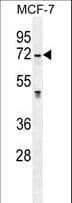 IHC-plus™ GALNS / Chondroitinase Antibody (aa236-263)