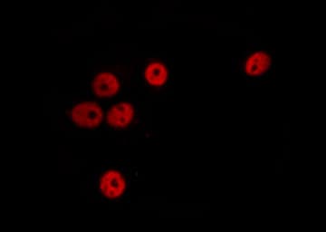 SSBP2 Antibody
