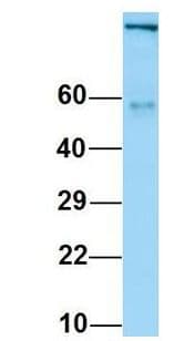 ITGAV/Integrin Alpha V/CD51 Antibody (C-Terminus)