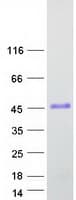 Human VCX Protein (Recombinant Myc-DDK (Flag))