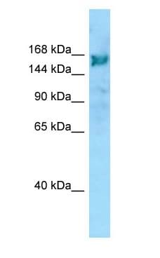 ARHGEF10 / GEF10 Antibody (aa1204-1253)