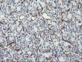 Monoclonal Mouse anti-Human PECAM-1 / CD31 Antibody (clone OTI1C2, IHC, WB)
