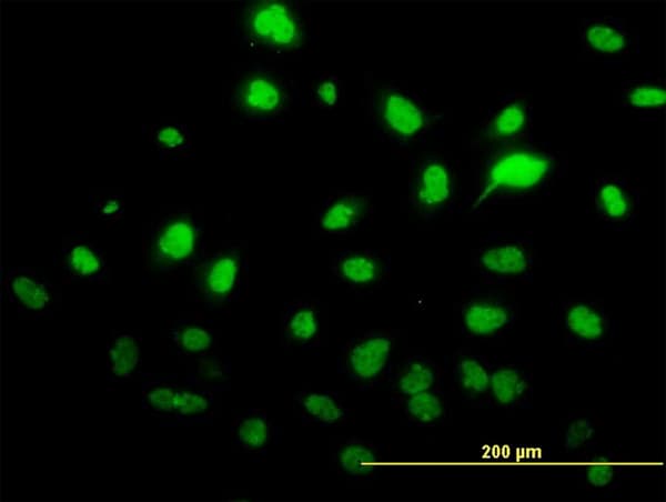 IHC-plus™ SAE1 Antibody (clone 1G4-1G5)