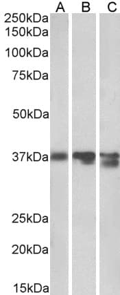 IHC-plus™ ARG1 / Arginase 1 Antibody (aa311-324)