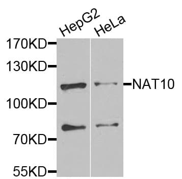 Polyclonal Rabbit anti-Human NAT10 Antibody (IHC, IF, WB)