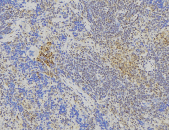 Polyclonal Rabbit anti-Human ST6GAL1 / CD75 Antibody (IHC, IF, WB)