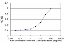 USP9Y Antibody (clone 2D3)