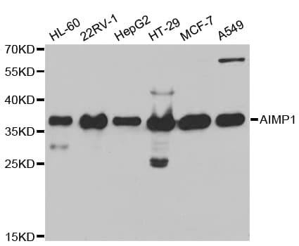 IHC-plus™ Polyclonal Rabbit anti-Human AIMP1 / EMAP II Antibody (IHC, IF, WB)