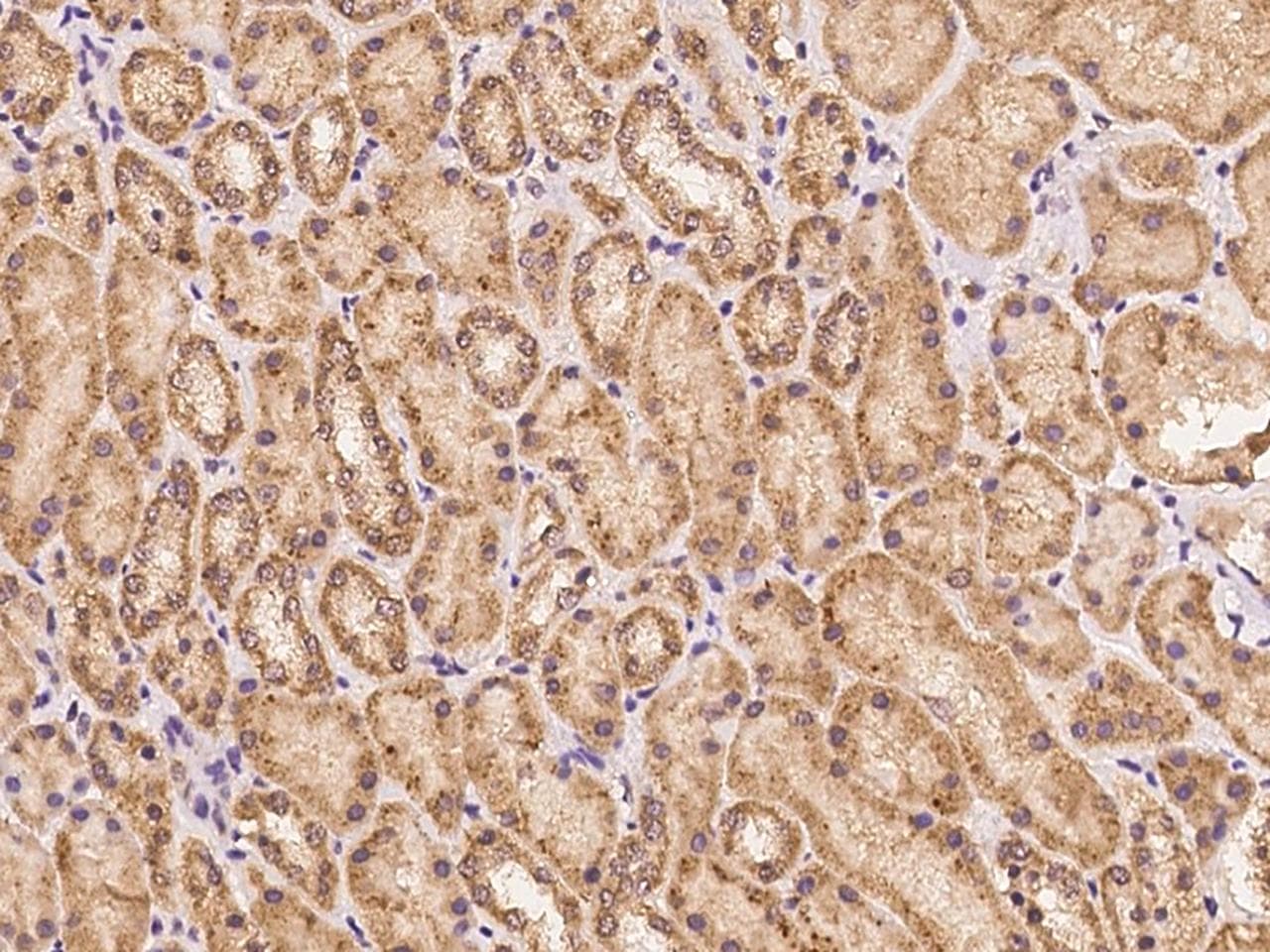 Polyclonal Rabbit anti-Human PDE1A Antibody (IHC)