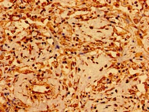 GSX1 / GSH1 Antibody