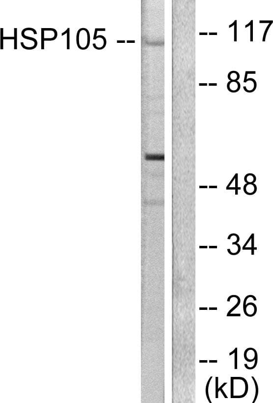 Polyclonal Rabbit anti-Human HSPH1 / HSP105 Antibody (IHC, IF, WB)